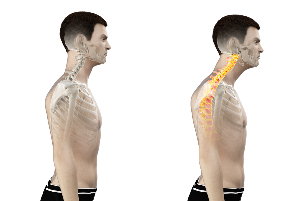 Tips to prevent 'tech neck' and other pain from technology use